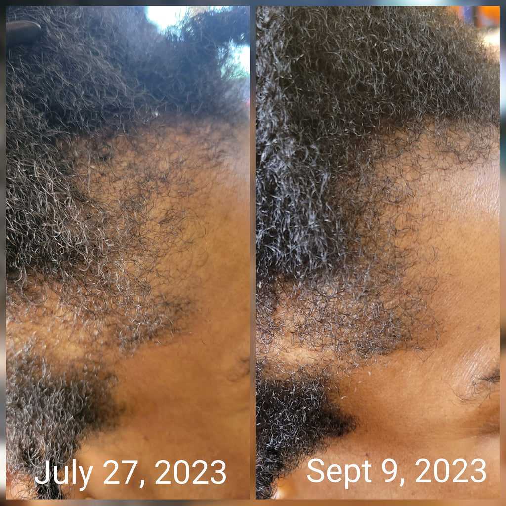 Ase Wellness Revival Hair Growth Oil